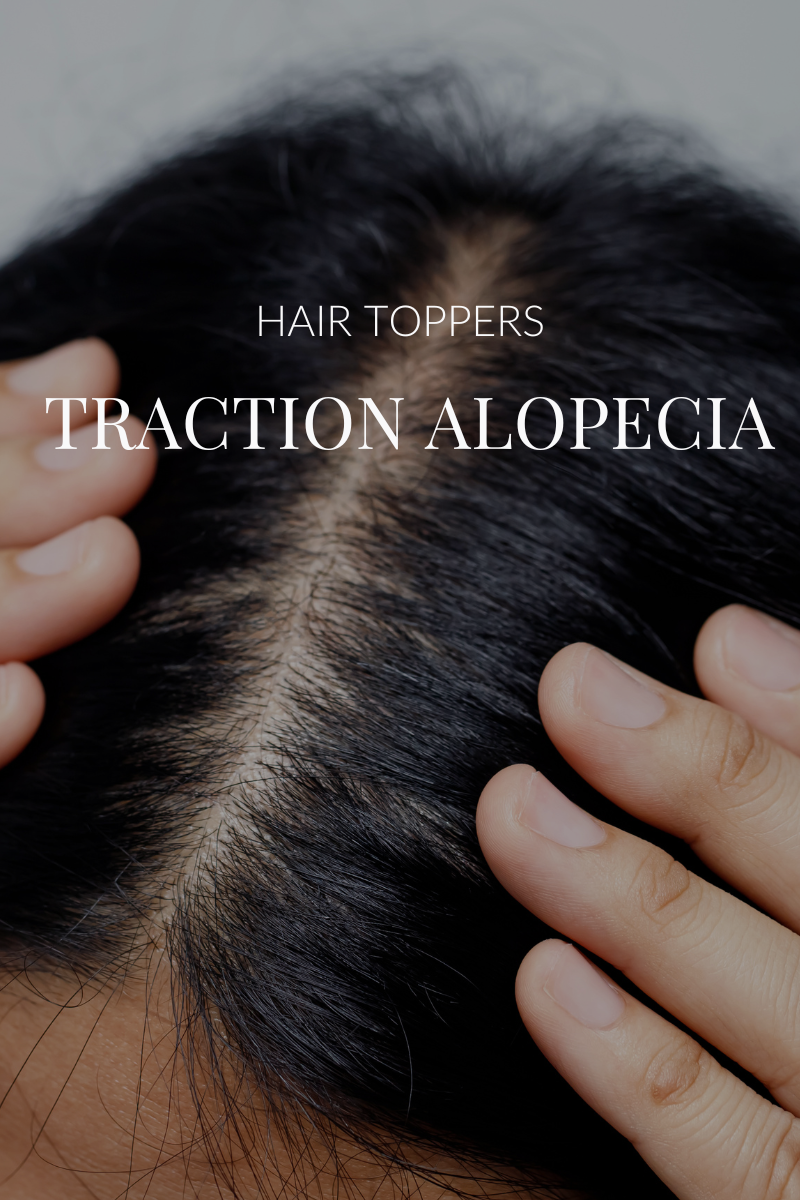Traction Alopecia and Hair Toppers | Avoiding Hair Loss with Proper Sizing and Application
